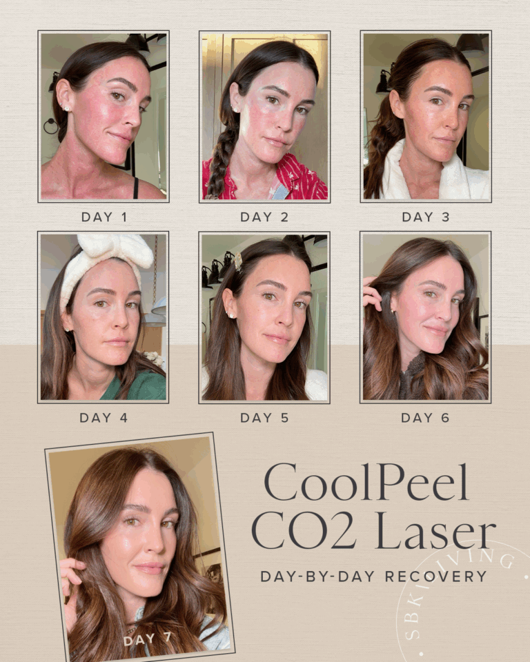 cool peel co2 laser